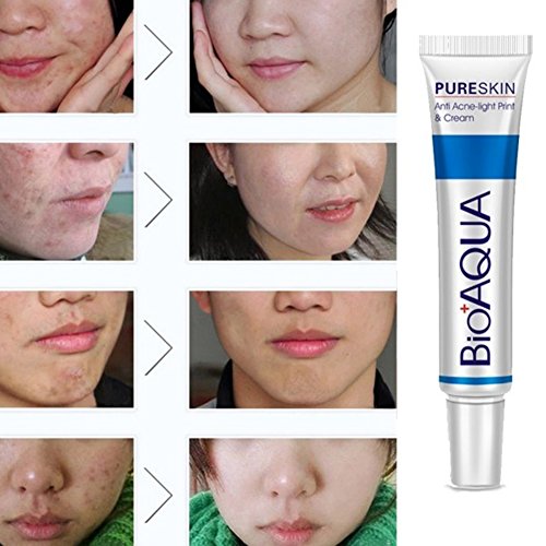 BIOAQUA Acne Scar Repair Cream for Face - Blemish & Mark Treatment