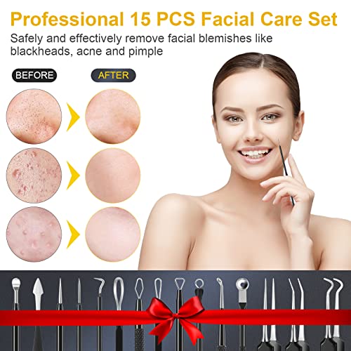 15-Piece Professional Stainless Steel Pimple Popper and Blackhead Remover Kit
