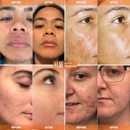 SeoulCeuticals 20% Vitamin C Serum with Ferulic Acid - Korean Skin Care 1 oz