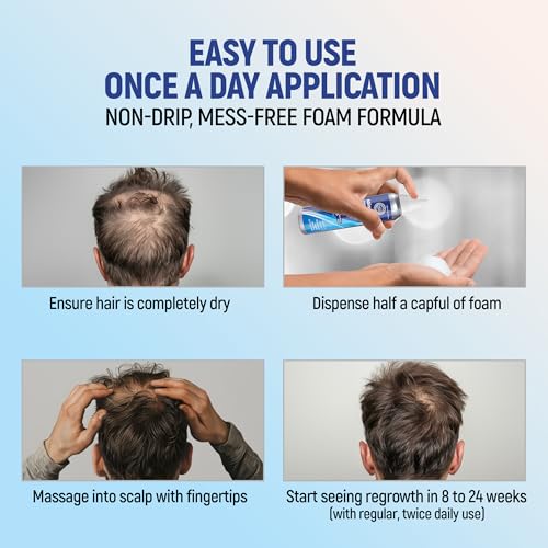 Minoxidil 5% Topical Aerosol Foam, Hair Regrowth 4 Months Treatment for Men, 2.11 oz (4 Pack)