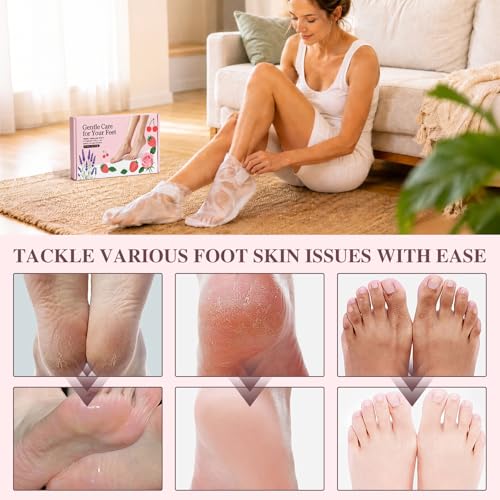 ZKONLY 8-Pack Foot Mask Set for Dry Cracked Heels and Callus Repair