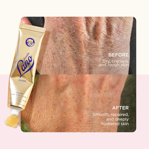 Lanolips Golden Dry Skin Salve with Lanolin, Manuka Honey & Vitamin E (25g)