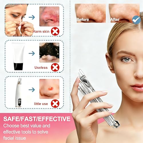 Professional 60PCS Stainless Steel Pimple Popper Tool Kit