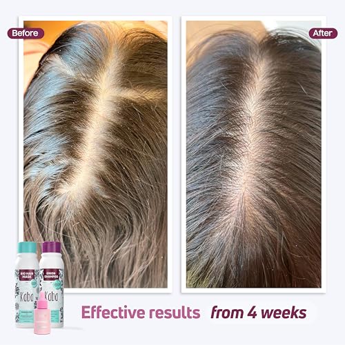D'Luchi Hair Treatment Kit for Growth & Intense Care, Set of 3 - Complete Hair Care Set with Bag, Includes Red Onion Shampoo & Hair Tonic.
