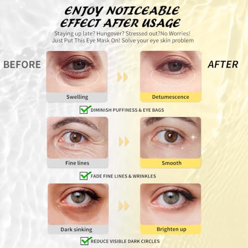 Maskiss Eye Masks Gift Set - 15 Pairs Under Eye Patches for Dark Circles and Puffiness