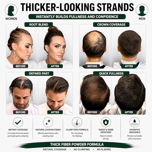 THICK FIBER Hair Fibers | Hair Powder for Thinning Hair 28g Bottle | Makes Thin Hair Look Thicker in Seconds | Hair Loss Concealer For Women & Men (Dark Brown)
