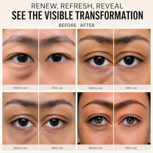 TrySafe PDRN & Calcium Under Eye Patches - 16 Pairs for Dark Circles & Wrinkles