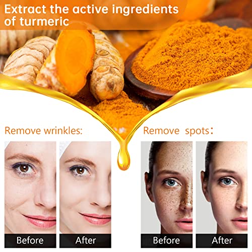 Kurchugo Turmeric Serum — Dark Spot Corrector for Face & Body, 1 Fl Oz