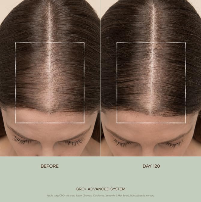 VEGAMOUR GRO+ Advanced Essentials Kit - Boost Hair Density, Reduce Shedding | Color Safe, Vegan, Cruelty-Free