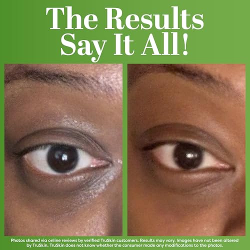 TruSkin Peptide Eye Cream Gel for Dark Circles & Fine Lines