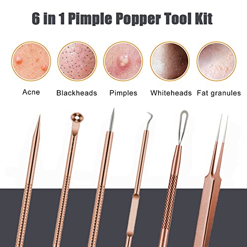 BLAAROOM Rose Gold 6-Piece Pimple Extractor Kit - Blackhead & Acne Removal Tools