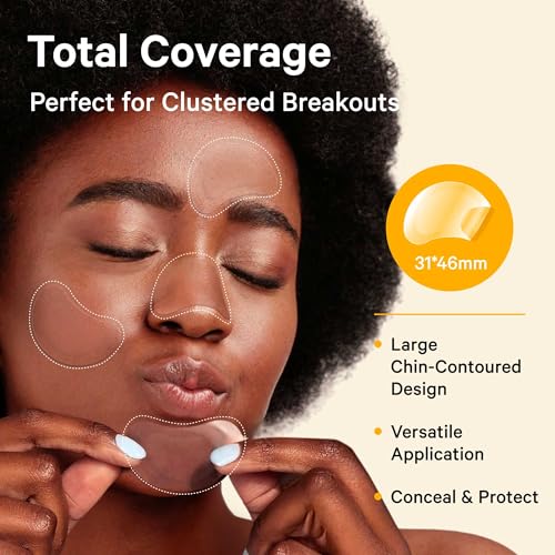 Sosky Large Chin Pimple Patches 12 Count Hydrocolloid Acne Spot Cover for Breakouts