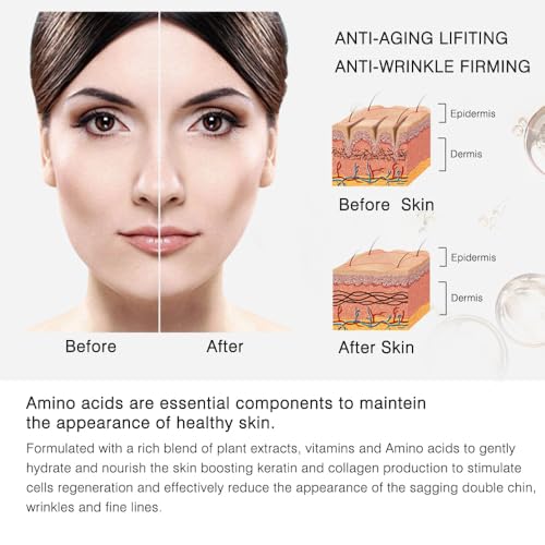 V-Line Lifting Mask, Collagen Chin Strap for Jawline & Double Chin (8 Pack)