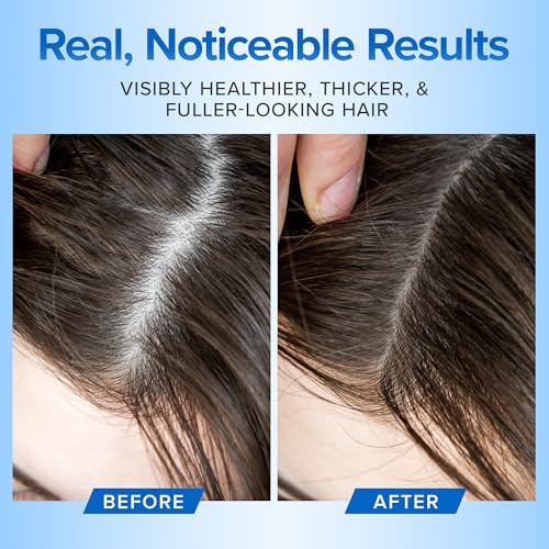 DermaChange Thick & Full Hair Growth Shampoo 8oz - Volumizing, Sulfate-Free for Thinning Hair & Hair Loss