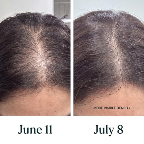 Puralis Thinning Hair Serum with Peptides & Caffeine for Hair Growth - Scalp Roll-On Treatment