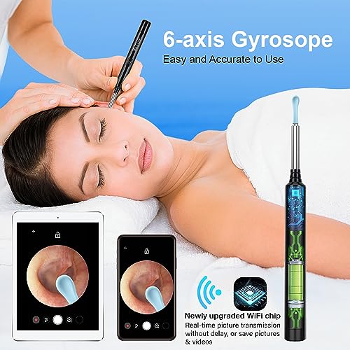 Wireless Ear Wax Removal Camera Kit 1296P HD with 6 Ear Tools & LED Lights