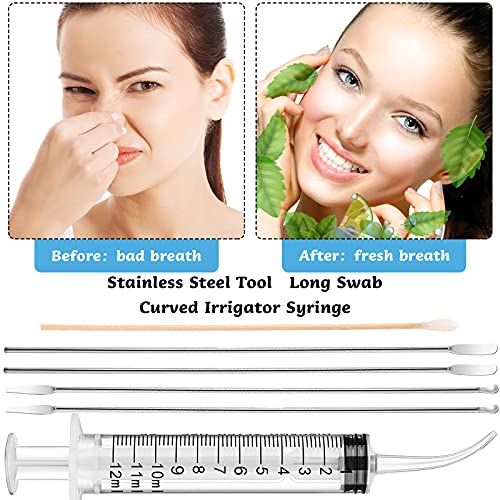 Tonsil Stone Removal Set - 4 Stainless Steel Tools & 100 Swabs