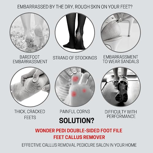 WONDER PEDI Stainless Steel Double-Sided Foot File for Callus Removal
