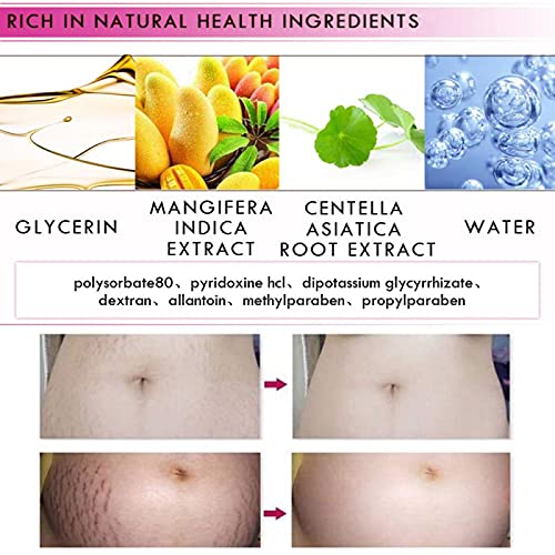 Mango Stretch Marks and Scar Cream, Stretch Mark and Scar Removal Cream for Pregnancy, Belly Creams for Wrinkles, Obesity Fat Marks Scars Moisturizing, Remove Marks (40g)