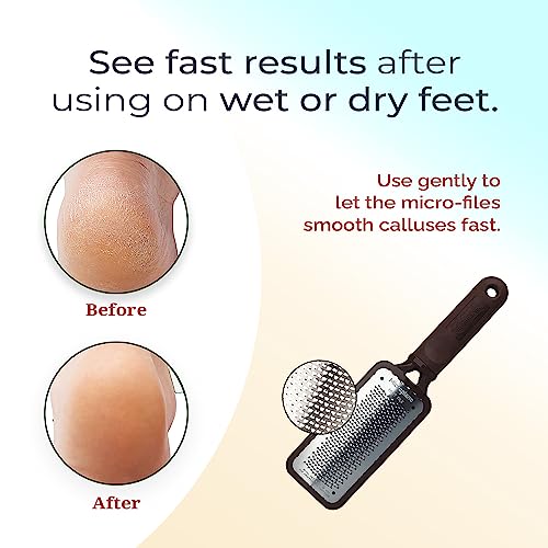 Microplane Colossal Foot File - Stainless Steel Callus Remover for Smooth Feet