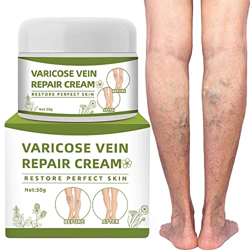 Varicose Veins Repair Cream - Leg Spider Vein Treatment Treatment 50g