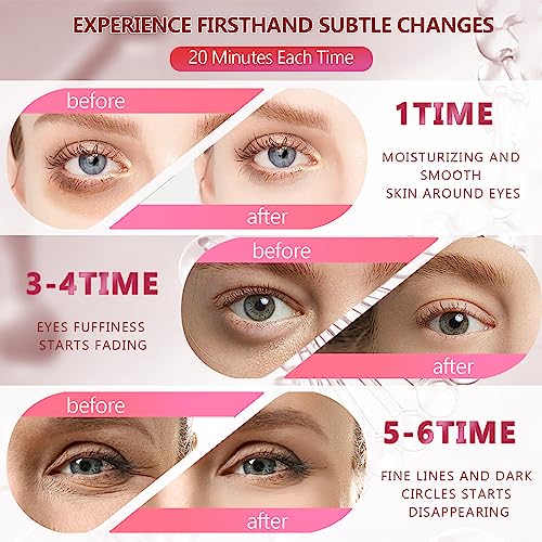 Yargkos Collagen Under Eye Patches - 90 Pairs Hydrating Gel Eye Masks Set