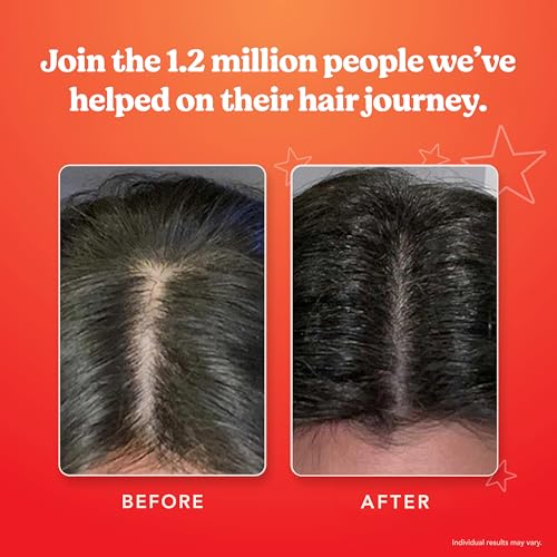HAIRtamin Gorgeous Growth Scalp Serum for Thicker, Stronger Hair