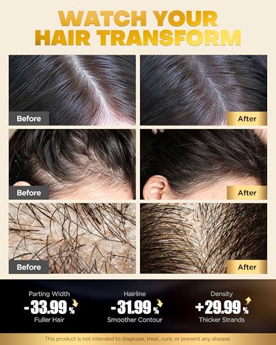 Biotin Hair Growth Shampoo & Conditioner Set for Stronger Hair