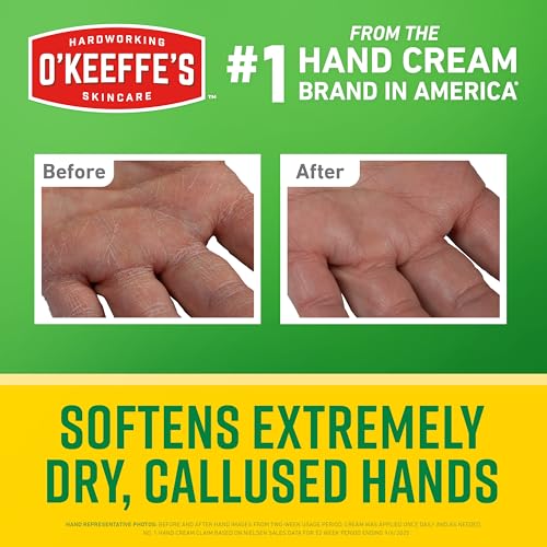 O'Keeffe's Working Hands Intense Renewal Cream, 3 oz - 48 Hour Hydration for Extremely Dry Skin