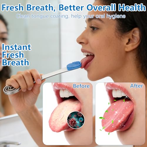 ROMALOVE Double-Ended Stainless Steel & Silicone Tongue Scraper for Adults