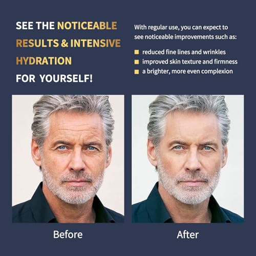 QZQETET Men’s Anti-Aging Face Moisturizer with Collagen, Retinol & Hyaluronic Acid - 1.7 OZ