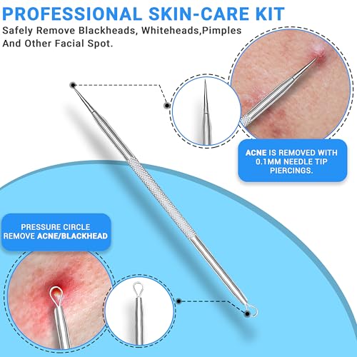 EFAH Care Stainless Steel Pimple Extractor Tool Set - 2 Pcs