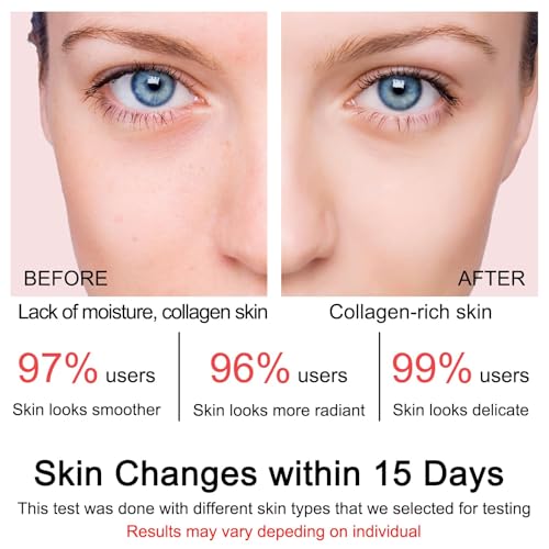Collagen Jelly Cream with Niacinamide - Hydrating & Firming for All Skin Types (3.38 Fl.Oz)