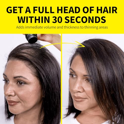 SEVICH Hair Fibers for Thinning Hair - 40g Dark Brown, Instant Volumizing Solution
