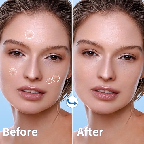 Daolyo 300 Pimple Patches for Face - 4 Sizes Hydrocolloid Acne Spot Treatment