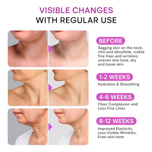 Remedial Paxwell Neck Firming Cream with Retinol, Collagen & Hyaluronic Acid