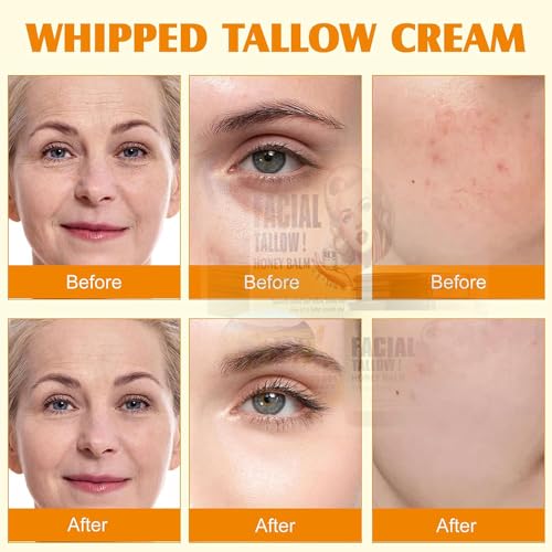 Whipped Tallow Honey Balm - Natural Moisturizer 4.02 Fl Oz