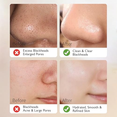 Charcoal Peel-Off Blackhead Remover Mask - 2.1 oz for Nose & T-Zone