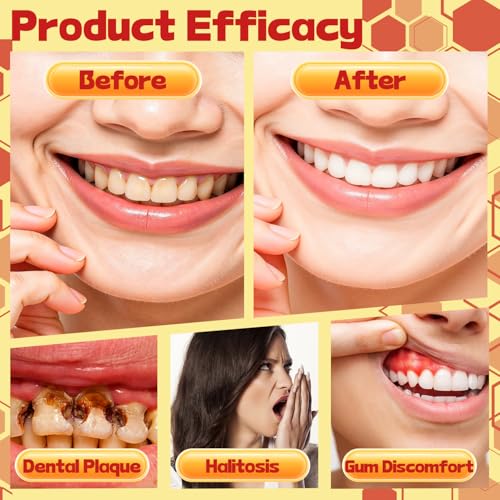 URMNI Bee Venom Toothache Spray for Adults - Yellow, Instant Tooth Pain Relief