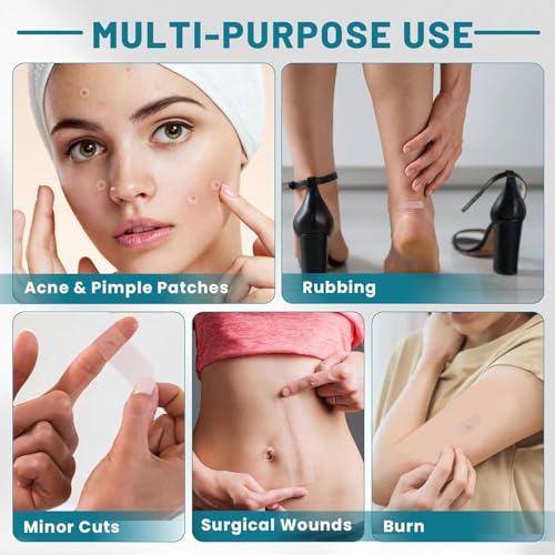 Hydrocolloid Pimple Patch Roll - Customizable Acne Treatment