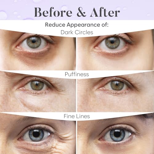 BLOOMORA Under Eye Patches for Dark Circles & Puffiness - 30 Pairs