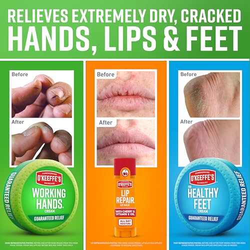 O'Keeffe's Giftbox Including Lip Repair with Cherry and Vitamin E Oil Stick, Working Hands Jar and Healthy Feet Jar, Gift Idea for Moms, Fathers, Caretakers, and More