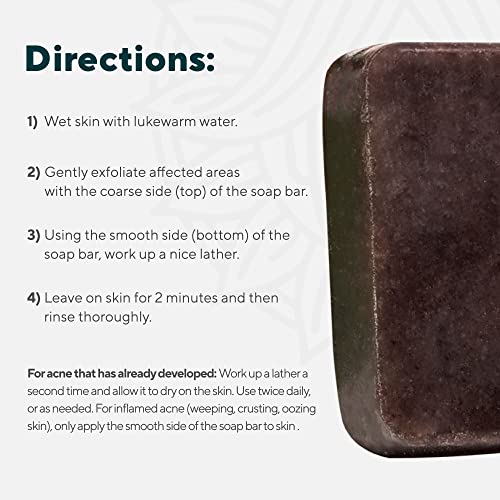 Marie Originals Acne Bar Soap with Bentonite Clay & Oat Bran