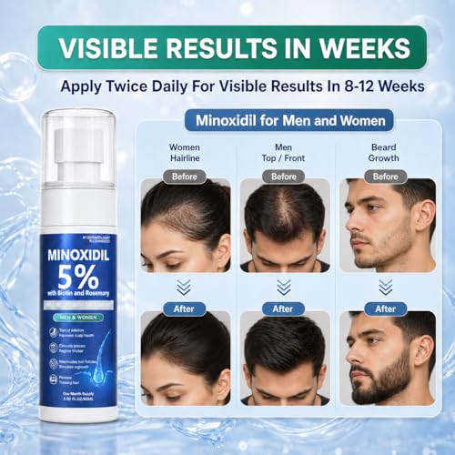 Rylx Minoxidil Hair Growth Serum for Men & Women - Extra Strength 60ML