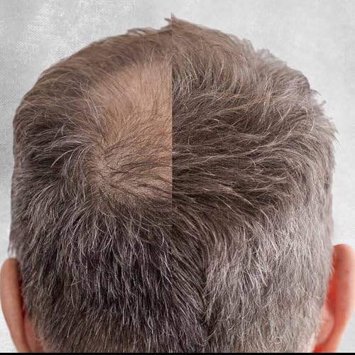 TruTress Hair Building Fibers - Black Keratin Concealer for Thinning Hair, 28g