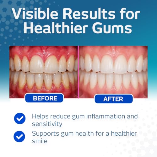 Vitis Gums Toothpaste 100ml – Gum Health & Enamel Strengthening
