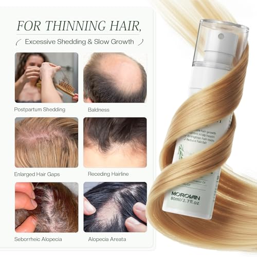 Morovan Hair Growth Spray - 30 Days to Thicker Hair with Batana & Castor Oil