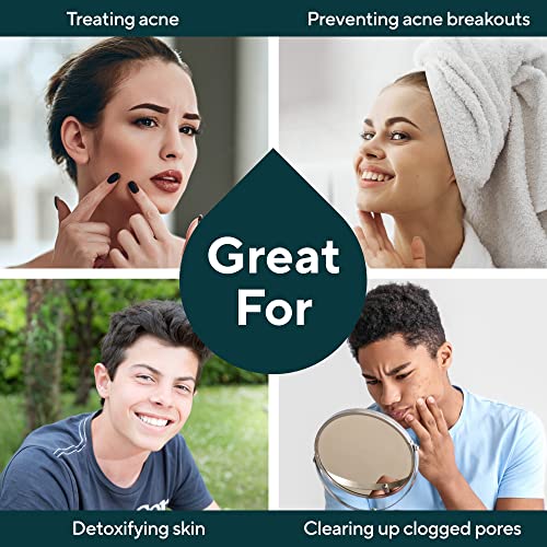 Marie Originals Acne Bar Soap with Bentonite Clay & Oat Bran