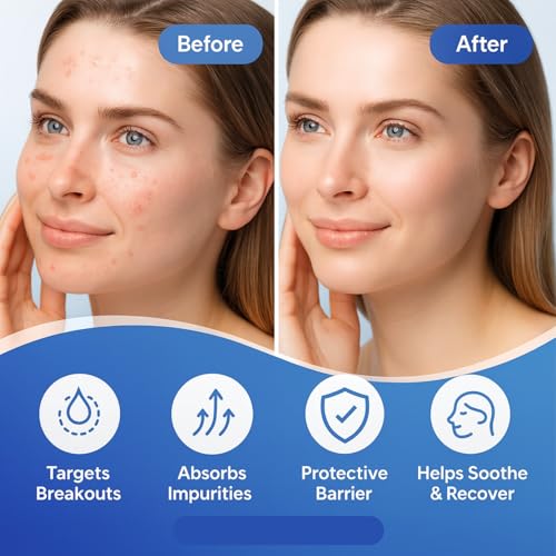 CLEARI Pimple Patches - 72 Ultra-Thin Acne Spot Covers