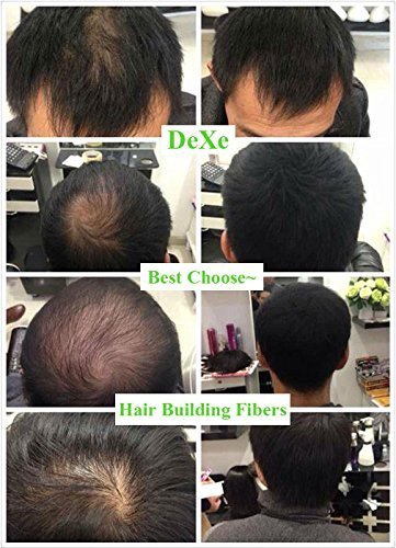 Dexe Hair Building Fibers - Medium Brown, 22g for Thinning Hair